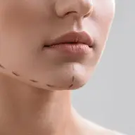 Remodelarea bărbiei: cum se poate face și ce presupune intervenția?