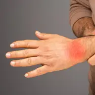 Ghid complet pentru controlul inflamației în organism