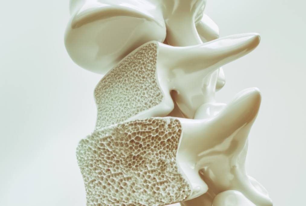 Uită de hernia de disc și osteoporoză cu aceste proceduri minim invazive