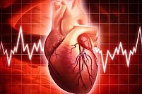 Ce sunt Aritmiile Cardiace?