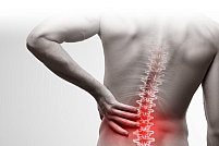 Top 5 cauze ale durerilor lombare de spate